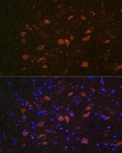 Immunofluorescence analysis of rat brain using Anti-HuD Antibody (A8714) at a dilution of 1:100. DAPI was used to stain the cell nuclei (blue).