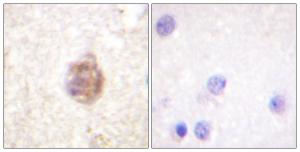 Immunohistochemical analysis of paraffin-embedded human brain using Anti-IRS-1 (phospho Ser794) Antibody. The right hand panel represents a negative control, where the antibody was pre-incubated with the immunising peptide.