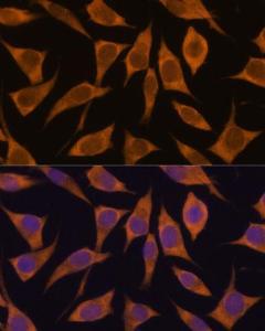 Immunofluorescence analysis of L929 cells using Anti-MRPL34 Antibody (A305260) at a dilution of 1:100. DAPI was used to stain the cell nuclei (blue)