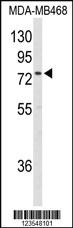 Anti-EXT2 Rabbit Polyclonal Antibody