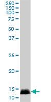 Anti-CALML3 Mouse Polyclonal Antibody