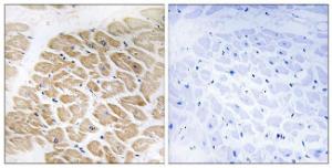 Anti-Melanoma Inhibitory Activity Rabbit Polyclonal Antibody