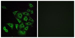 Anti-OR4K14 antibody