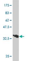 Anti-TFAP2B Mouse Monoclonal Antibody [clone: 2F6]