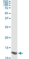 Anti-LGALS1 Antibody Pair