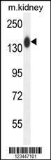 Anti-COL19A1 Rabbit Polyclonal Antibody (PE (Phycoerythrin))