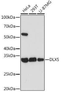 Anti-Dlx5 Rabbit Monoclonal Antibody [Clone: ARC1994]