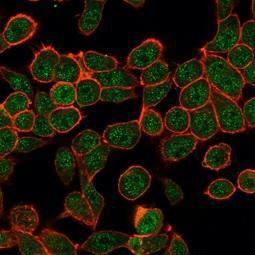 Immunofluorescent analysis of PFA fixed HeLa cells stained with Anti-ZBTB7B Antibody [PCRP-ZBTB7B-1F7] followed by Goat Anti-Mouse IgG (CF&#174; 488) (Green). Counterstain is Phalloidin-CF&#174; 640A (Red)