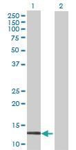 Anti-CALML3 Mouse Polyclonal Antibody