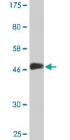 Anti-VBP1 Mouse Monoclonal Antibody [clone: 1B4]