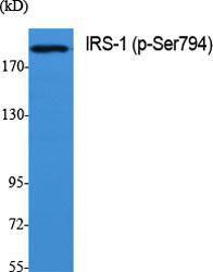 Western blot analysis of various cells using Anti-IRS-1 (phospho Ser794) Antibody