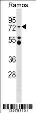 Anti-MTA3 Rabbit Polyclonal Antibody (Biotin)