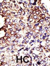 Anti-GCNT1 Rabbit polyclonal antibody