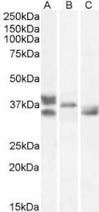 Anti-RNLS Antibody (A83355) (1 µg/ml) staining of Human Heart (A), Mouse Heart (B), Rat Heart (C) lysates (35 µg protein in RIPA buffer) Primary incubation was 1 hour Detected by chemiluminescence