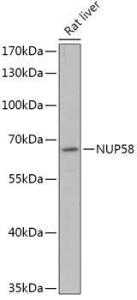 Western blot analysis of extracts of Rat liver, using Anti-NUP58 Antibody (A305262) at 1:1,000 dilution