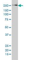 Anti-FASN Mouse Monoclonal Antibody [clone: 3F2-1F3]