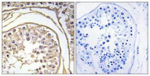 Anti-BAGE2 Rabbit Polyclonal Antibody