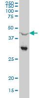 Anti-NR0B1 Mouse Monoclonal Antibody [clone: 1F10]