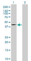 Anti-FASN Mouse Monoclonal Antibody [clone: 3F2-1F3]