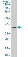 Anti-PPM1M Mouse Polyclonal Antibody