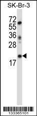 Anti-LIN52 Rabbit Polyclonal Antibody (Biotin)