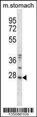 Anti-TP53RK Rabbit Polyclonal Antibody (Biotin)