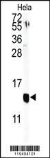 Anti-B2M Rabbit Polyclonal Antibody