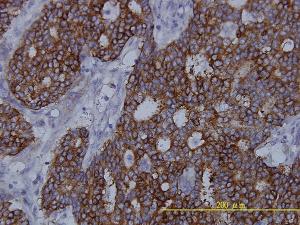 Anti-FASN Mouse Monoclonal Antibody [clone: 3F2-1F3]