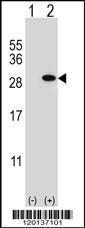 Anti-GSTT1 Rabbit Polyclonal Antibody (Biotin)