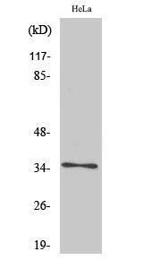 Anti-OR4K14 antibody