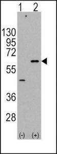 Anti-AKT3 Rabbit Polyclonal Antibody (HRP (Horseradish Peroxidase))