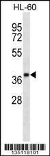 Anti-OR5F1 Rabbit Polyclonal Antibody (Biotin)