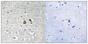 Immunohistochemical analysis of paraffin-embedded human brain using Anti-IRAK1 (phospho Ser376) Antibody. The right hand panel represents a negative control, where the antibody was pre-incubated with the immunising peptide