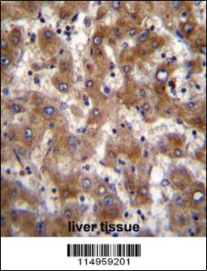 Anti-PLA2G2C Rabbit Polyclonal Antibody