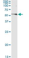 Anti-FASN Mouse Monoclonal Antibody [clone: 3F2-1F3]