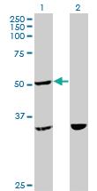 Anti-TTC4 Mouse Monoclonal Antibody [clone: 1E10]