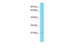 Anti-TEX38 Rabbit Polyclonal Antibody