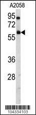 Anti-USP14 Rabbit Polyclonal Antibody (APC (Allophycocyanin))