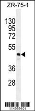 Anti-FUT4 Rabbit Polyclonal Antibody