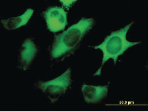 Anti-FASN Mouse Monoclonal Antibody [clone: 3F2-1F3]