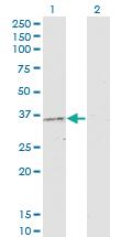 Anti-PRKAG2 Mouse Monoclonal Antibody [clone: 3C4]