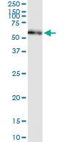 Anti-PDIA3 Polyclonal Antibody Pair