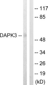 Western blot analysis of lysates from HUVEC cells using Anti-DAPK3 Antibody. The right hand lane represents a negative control, where the antibody is blocked by the immunising peptide