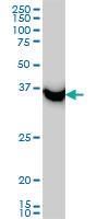 Anti-SAE1 Mouse Monoclonal Antibody [clone: 1G4-1G5]