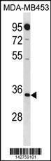 Anti-MTAP Rabbit Polyclonal Antibody (AP (Alkaline Phosphatase))