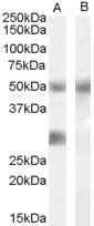 Anti-IGFBP3 Antibody (A83357) (0.02µg/ml) staining of Human Breast Cancer lysate (35µg protein in RIPA buffer) with (B) and without (A) blocking with the immunising peptide. Primary incubation was 1 hour. Detected by chemiluminescence.