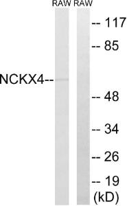 Anti-SLC24A4 Rabbit Polyclonal Antibody