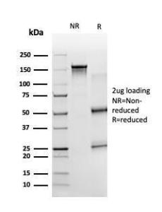 SDS-PAGE analysis of Anti-ZBTB7B Antibody [PCRP-ZBTB7B-1F7] under non-reduced and reduced conditions; showing intact IgG and intact heavy and light chains, respectively. SDS-PAGE analysis confirms the integrity and purity of the antibody