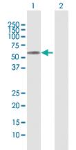 Anti-MMP3 Rabbit Polyclonal Antibody