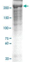 Anti-NF1 Rabbit Polyclonal Antibody